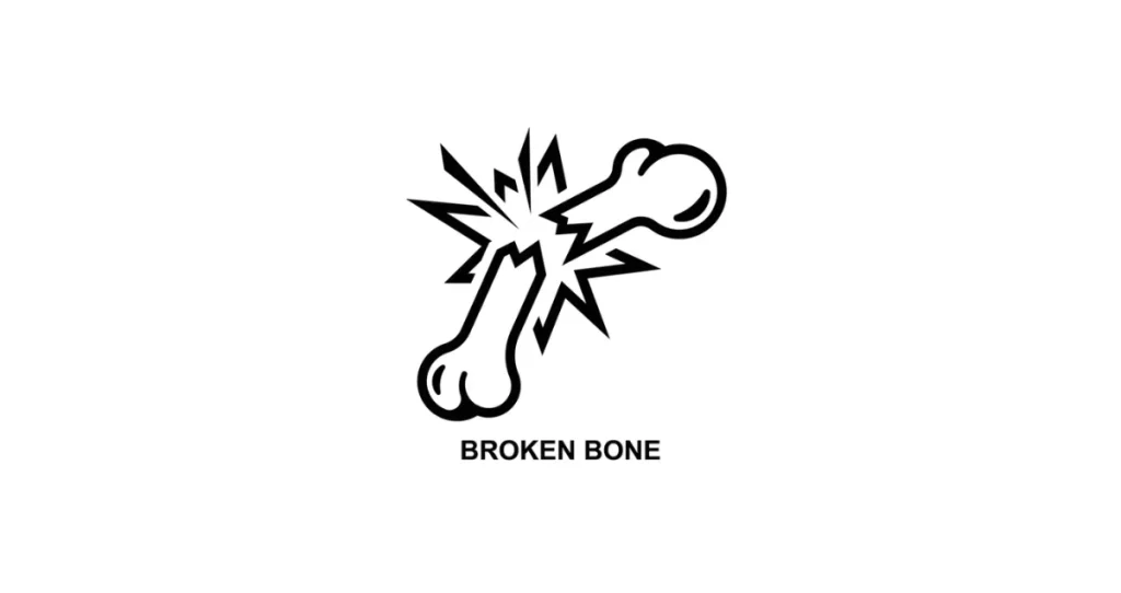 broken bones